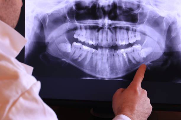 Best Emergency Root Canal Treatment in Nevada, IA