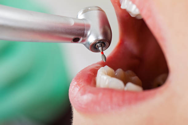 Best Emergency Treatment for Toothache in Nevada, IA